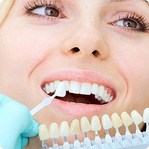 Профилактика зубных отложений